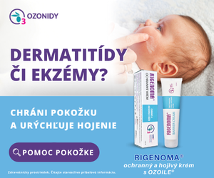 Vyhlásenie predsedu Hnutia Slovensko Igor Matovič! | AKTUALITA